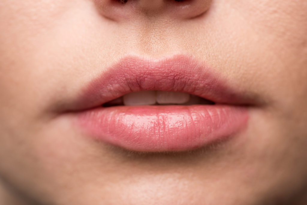 plump your lips with cinnamon naturally