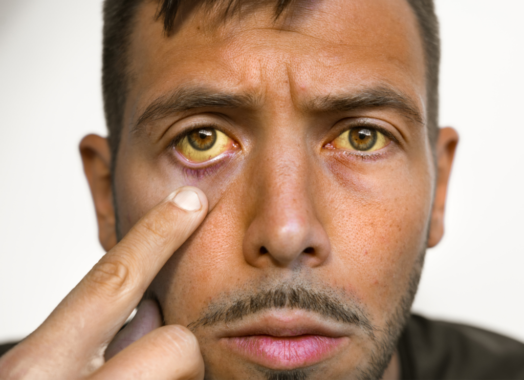 symptoms of liver problems